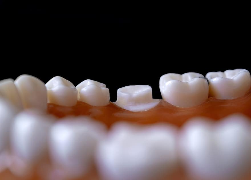 A Guide to Dental Med Spa