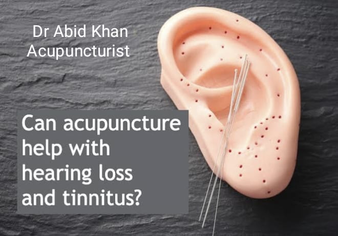 Deafness, personality and acupuncture