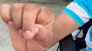 Groundbreaking Research: Riitesh Mudraa Shows Promise in Managing Cerebral Palsy (CP) Symptoms